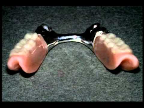 Dentadura parcial inferior - YouTube