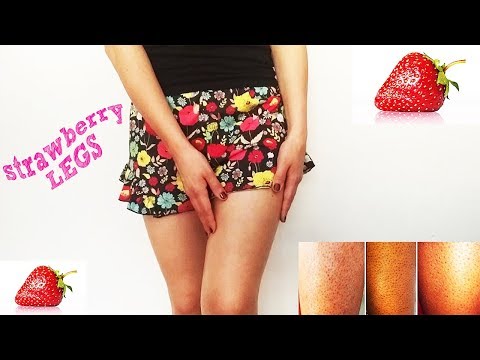 ხორკლიანი კანი, კიტრის სკრაბი, Batis kani