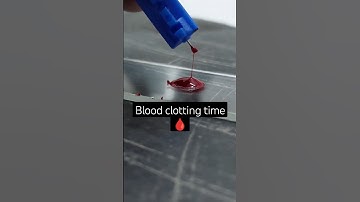BT CT Test performance #pathology #lab #medical #viral #status #shorts#bmlt #doctors #pathology