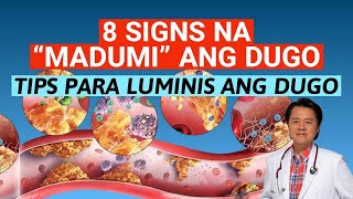8 Signs na "Madumi" ang Dugo. Tips Para Luminis ang Dugo. - By Doc Willie Ong
