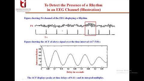Lecture 37 Detection of Rhythm in an EEG Signal