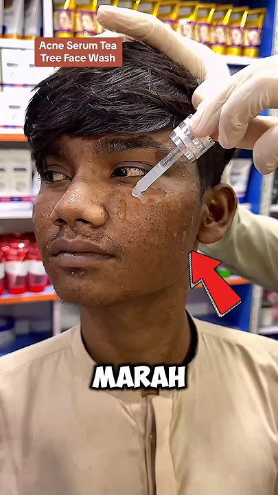 Pria ini memutuskan untuk menjadi tampan #shorts