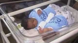 woman gives birth to black and white twin