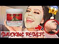 I USED THE AZTEC HEALING CLAY MASK WITH WATER ON MY SKIN FOR 5 DAYS (CRAZY RESULTS)