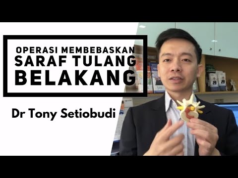 Tulang belakang merupakan bagian penting bagi manusia yang berfungsi membantu menegakkan tubuh. Seti. 