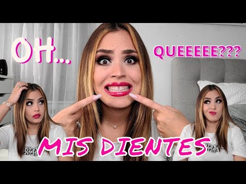 MIS DIENTES! Diastema, Bullying, Secretos, Mi historia...