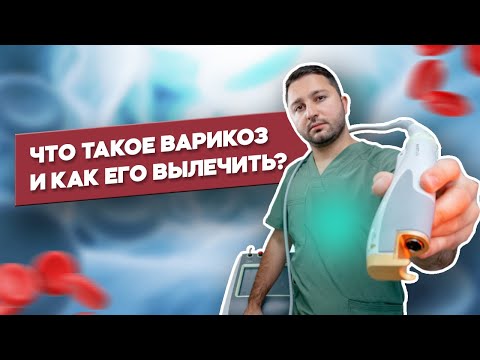 Как вылечить Варикоз ? Что такое ЭВЛК и КЛаКС (CLaCS) ?