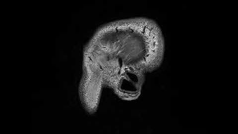 Animating layers of a brain CT [DICOM] file in Python and OpenCV