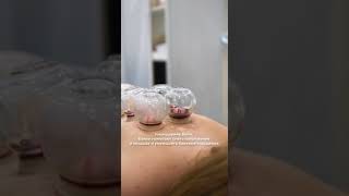 Процедура кровопускания хиджама #китайскаямедицина #shorts #китай