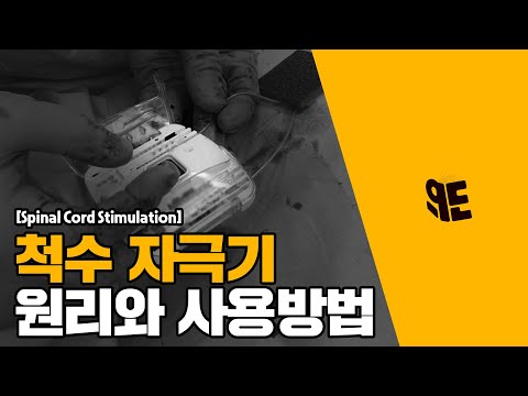 통증중재치료의 최신 트렌드를 알아보자│척수자극기의 임상적 적용(上)