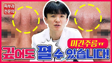 깊은 미간주름 치료하는 걸 보여달라고 하셔서 준비했습니다! ? 미간주름 1회차 치료 후기!