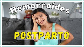 HEMORROIDES POSTPARTO 👉 Cómo eliminarlas y evitar el dolor!!