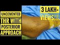 Uncemented Total Hip Replacement Surgery (Posterior Approach)