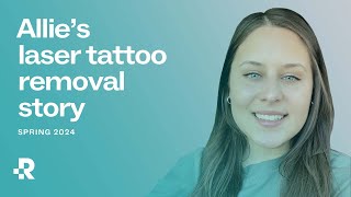 Allie's Laser Tattoo Removal Journey