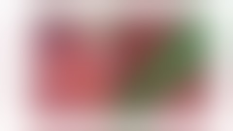 Tool Segmentation in Surgical Video - RSIP Vision