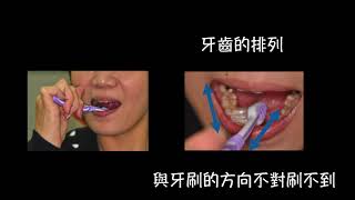 3.3 冠群牙醫 刷牙衛教 刷死角 刷肉- - 詳細版