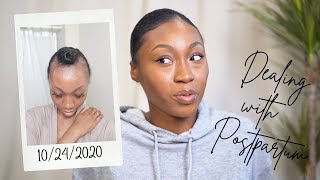 My Postpartum Hairloss Journey | Losing my hair ON MY WEDDING DAY!!!