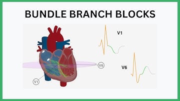 Bundle Branch Blocks Visualised