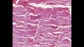 Shotgun Histology Dense Regular Connective Tissue