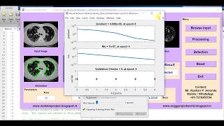 Lung Cancer Detection using Machine Learning