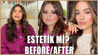 Estetik mi? 🙀 Before/After