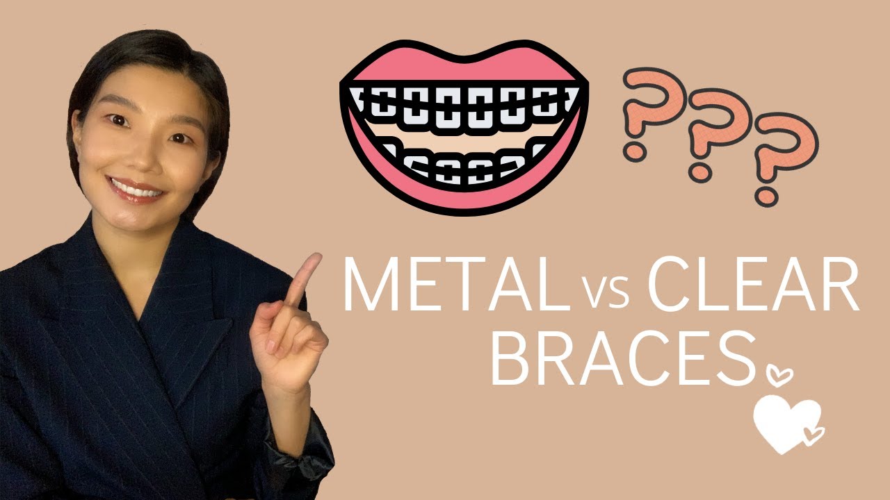 METAL vs CLEAR BRACES! ШҮДНИЙ АППАРАТНЫ ЯЛГАА🧐