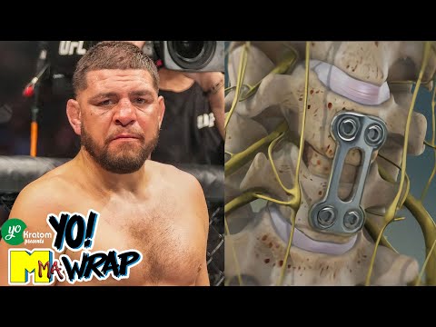 Nick Diaz’s Neck | Luis J. Gomez & Dave Smith