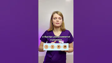 Срочно обратитесь к врачу, если у вашего ребёнка такие родинки 🥺