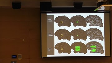 NeuroHackademy 2019: Satra Ghosh - Plumbing the Intertubes