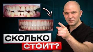 видео: Сколько Стоит Идеальная Улыбка? Цены на Стоматологию 2025 картинка: Сколько Стоит Идеальная Улыбка? Цены на Стоматологию 2025