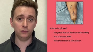 Face the Case - PNS and TMR for Managing Neuorpathic Pain