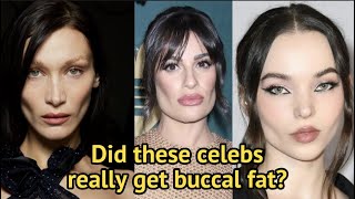 IS THIS WHAT BUCCAL FAT REMOVAL DOES?
