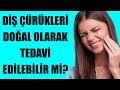 Diş Çürükleri Doğal Olarak Tedavi Edilebilir Mi?