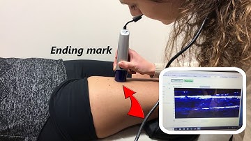 Ultrasound for Body Composition Analysis
