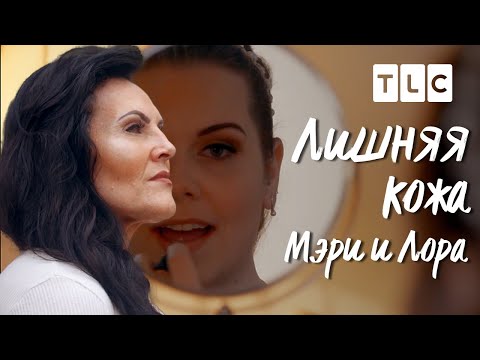 Мэри и Лора | Лишняя кожа | TLC