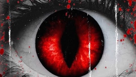 20 دقيقة من الرقية الشرعية لإزالة العين والحسد