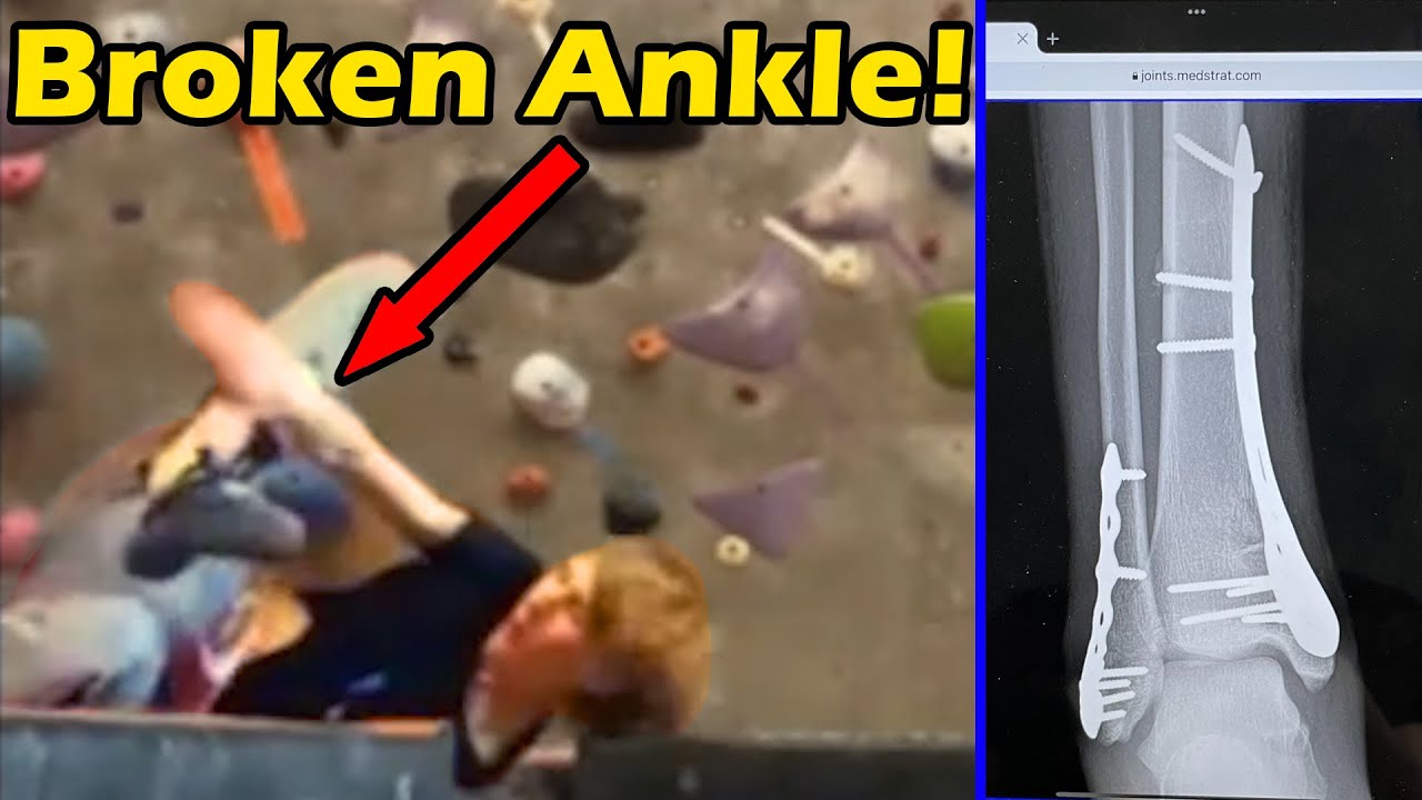 Самый опасный приём в скалолазании — Dynology #012