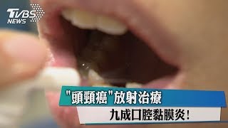 「頭頸癌」放射治療　九成口腔黏膜炎！