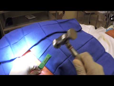 R3 2 Sign >> R3 Stem Cell Training Video - Bone Marrow Harvest ... R3 2 Sign >> R3 Stem Cell Training Video - Bone Marrow Harvest ...