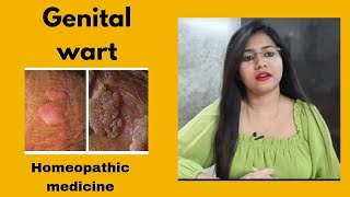 Genital warts symptoms,causes & treatment !! Homeopathic medicine for genital warts !! HPV infection