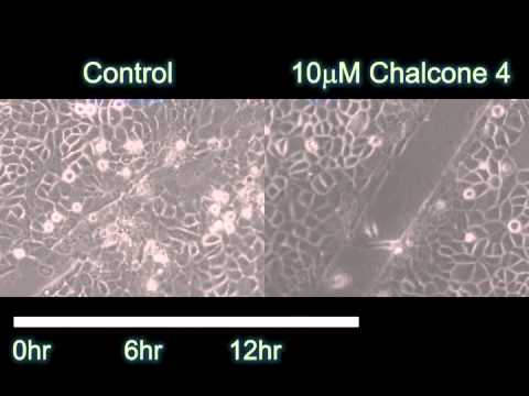 Video: Defektivna Angiogeneza U Miševima Sa Mutantima CXCL12 Umanjuje Regeneraciju Skeletnih Mišića
