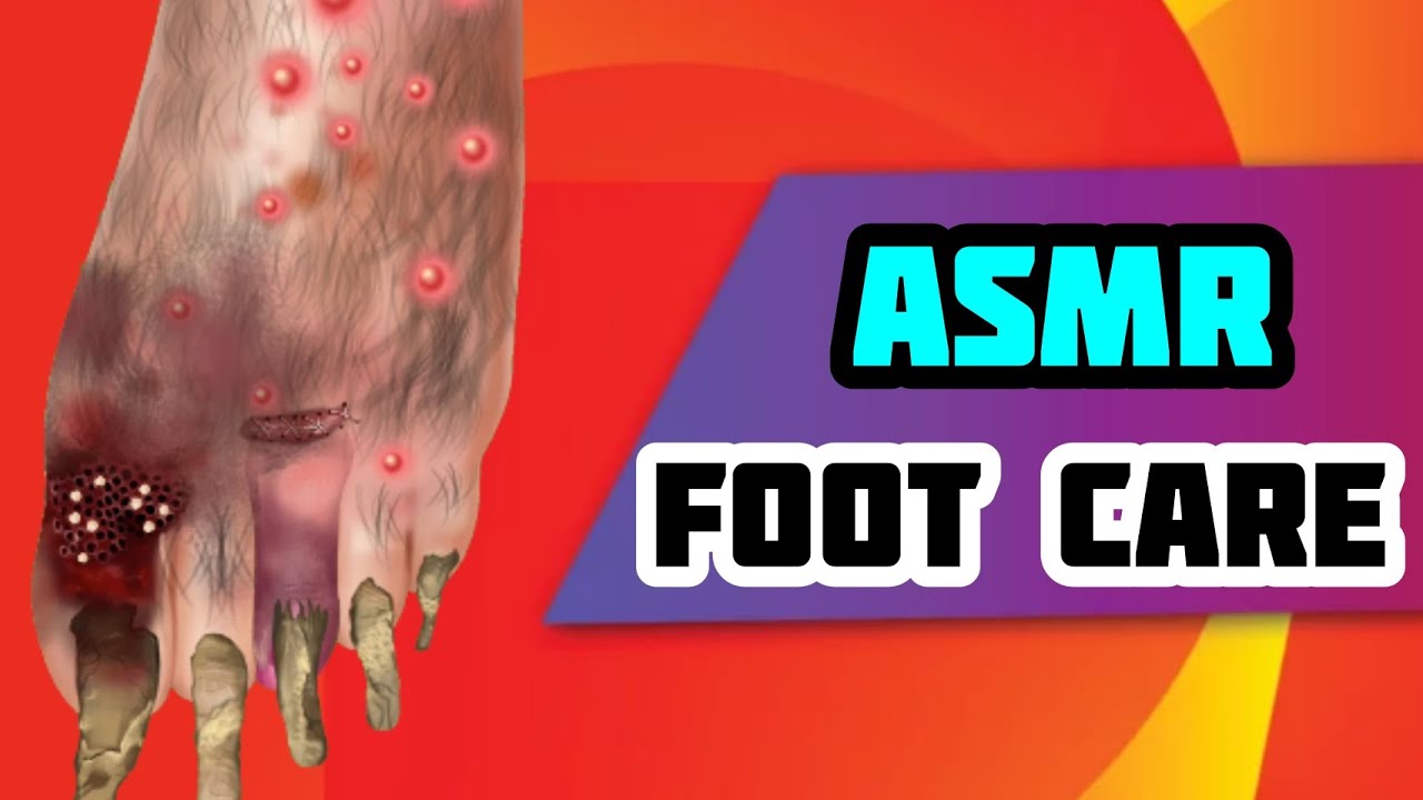 Foot care/ASMR Game YouTube