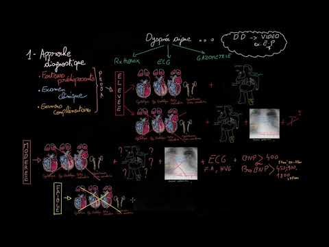 Vidéo: Insuffisance Cardiaque Aiguë: Types, Causes Et Symptômes