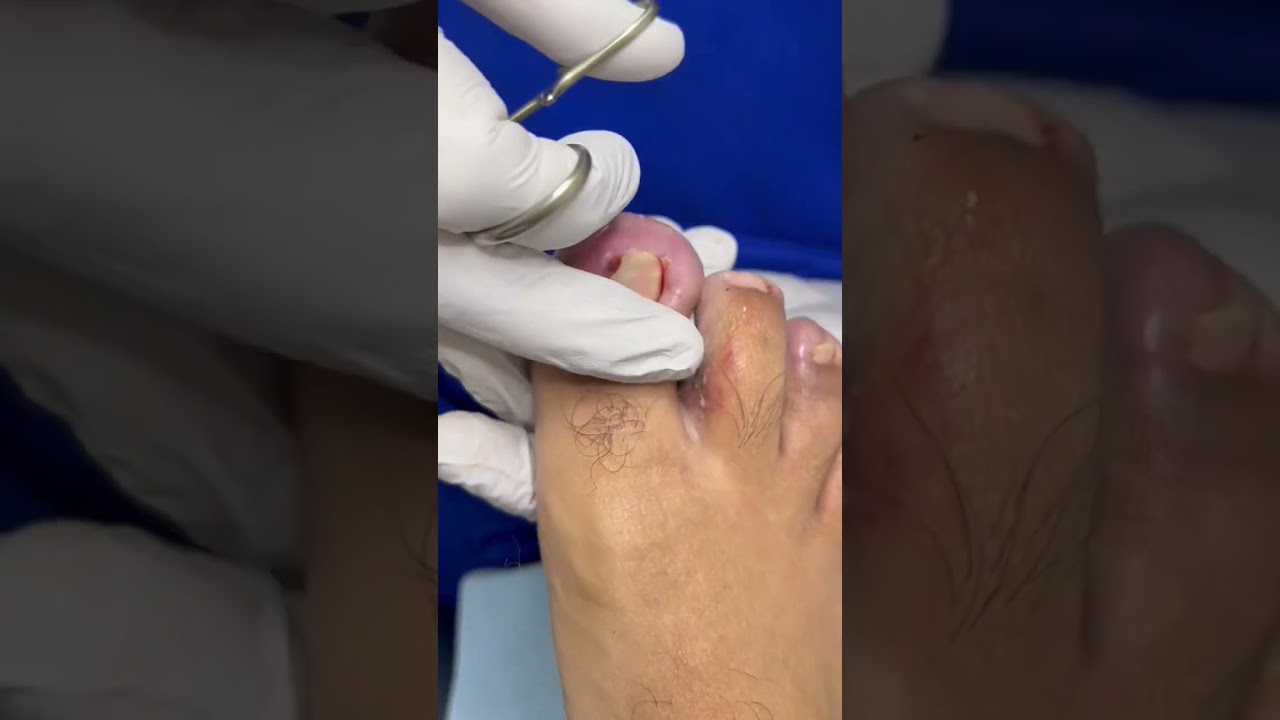 8. ¿Es recomendable buscar varias opciones de podólogos y comparar precios antes de tomar una decisión?