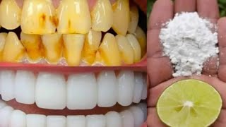 दांतो को मोतियों जैसे चमका देता हैं ये घरेलू नुस्खा।Teeth Whitenning challenge।।