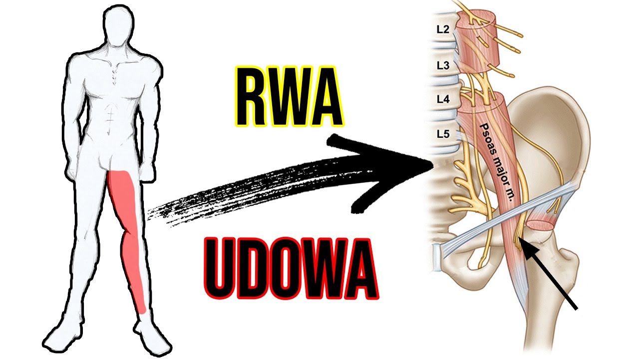 RWA UDOWA - ból pleców i drętwienie nogi | Ćwiczenia + ciekawostka 🧐