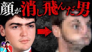 【実話】顔半分が銃で消し飛んだ男…顔面を全て移植した末路とは…？【怖い話】