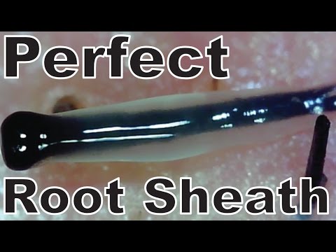 Hair Root Close Up Part 22 完全無欠な透明毛根鞘を超接写 Perfect Root Sheath 長さ 7 56 動画ニュース Hair Root Close Up Part 22 完全無欠な透明毛根鞘を超接写 Perfect Root Sheath 長さ 7 56 動画ニュース
