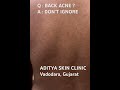Back acne is common—but completely treatable . Don’t ignore repeated breakouts on your back.