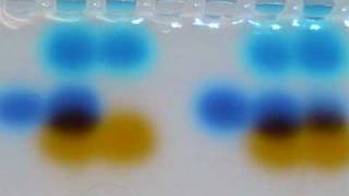 Dna Gel Electrophoresis Lab